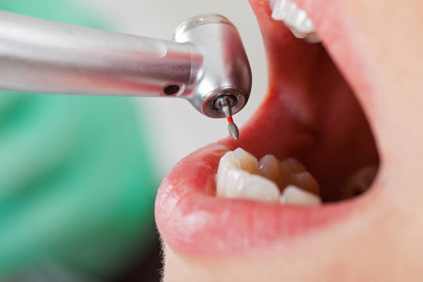 Best Emergency Dental Services for Seniors in Stevens Point, WI